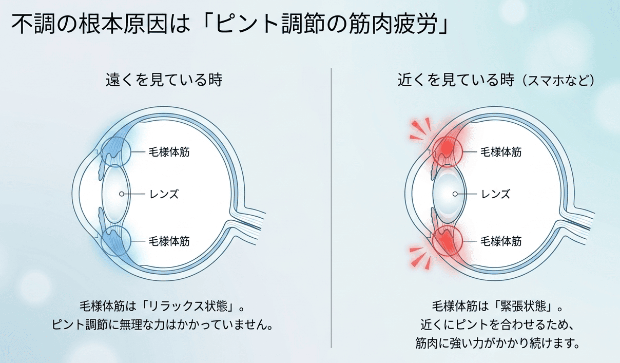 遠くを見ている時と近くを見ている時の毛様体筋の状態を比較した図解。近くを見る時は毛様体筋が緊張状態になり、疲労の原因となることを示す